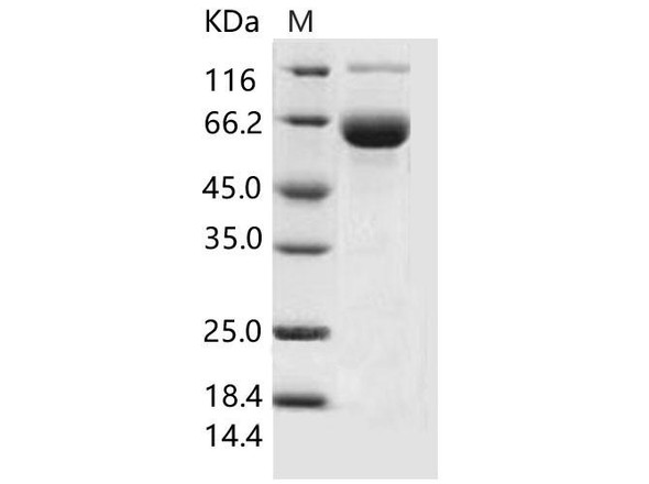 Mouse SIGLEC3/CD33 Recombinant Protein (RPES1863)