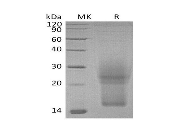 Mouse Interleukin-3/IL-3 Recombinant Protein (RPES1883)