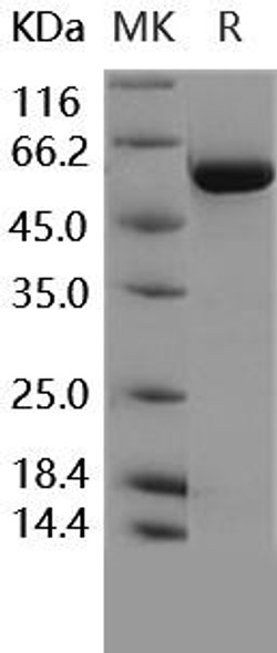 Human TGFBR1/ALK-5 Recombinant Protein (RPES1889)