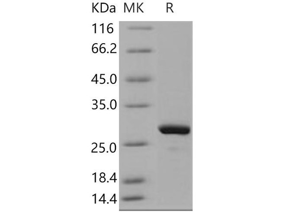 Human MAD2L1/MAD2 Recombinant Protein (RPES1890)