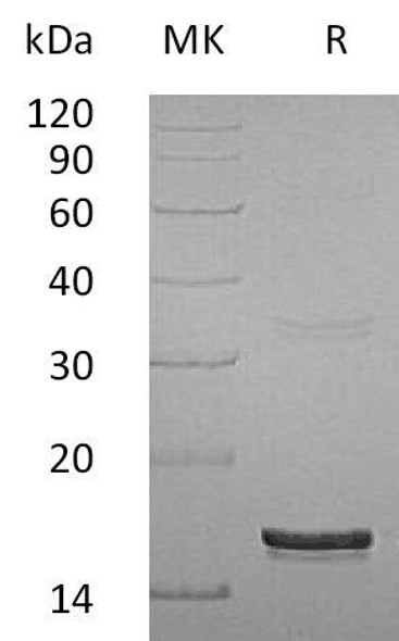 Human Interferon gamma/IFNG Recombinant Protein (RPES1899)