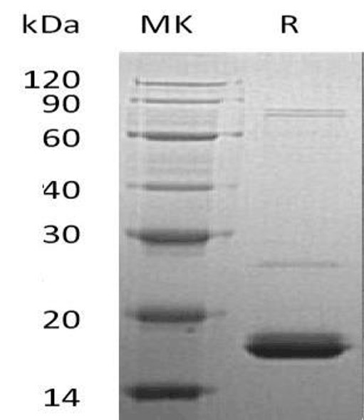 Human Cytochrome b5/CYB5A Recombinant Protein (RPES1919)