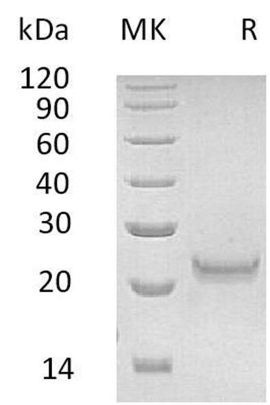 Human Interferon omega/IFNW1 Recombinant Protein (RPES1920)