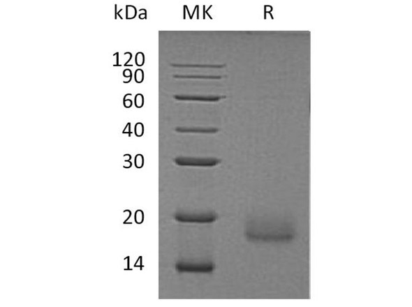 Human ALK-2/ACVR1 Recombinant Protein (RPES1938)
