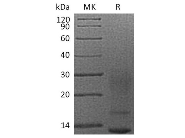 Human Interleukin3/IL3 Recombinant Protein (RPES1940)