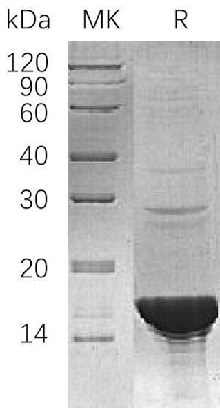 Human UBE2B/HR6B Recombinant Protein (RPES1942)