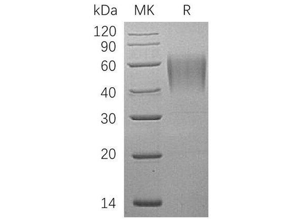 Human ICAM-2/CD102 Recombinant Protein (RPES1949)