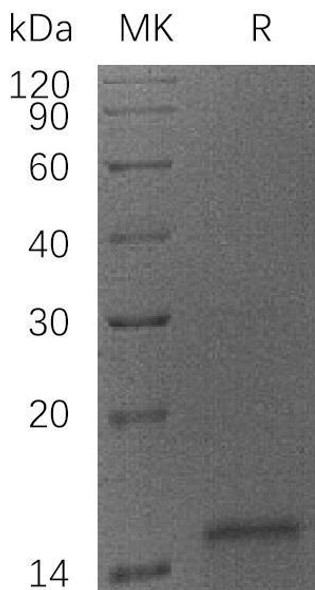 Human Cytochrome C/CYCS Recombinant Protein (RPES1958)