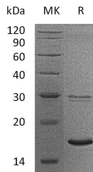 Human UBE2B/HR6B Recombinant Protein (RPES1961)