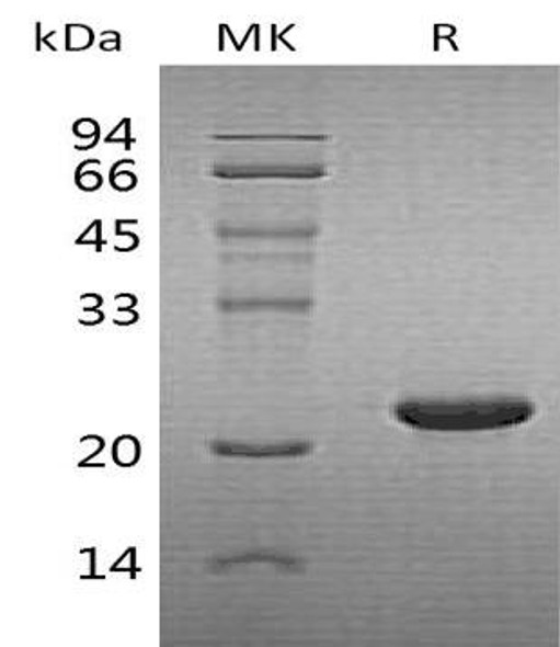 Human Cytoglobin/CYGB Recombinant Protein (RPES1978)