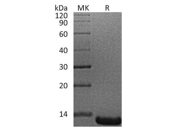 Human ACYP1 Recombinant Protein (RPES1987)