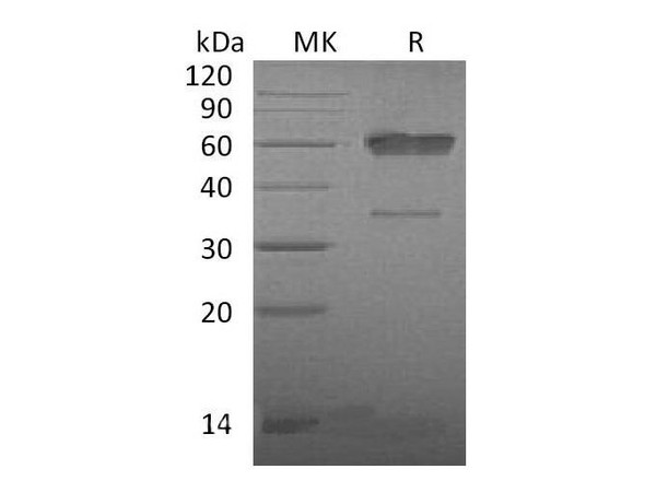 Mouse CD83/HB15 Recombinant Protein (RPES1989)