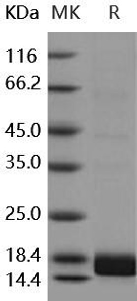 Human ALK-2/ACVR1 Recombinant Protein (RPES1990)