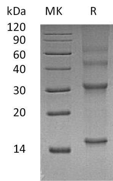 Human UBE2D3 Recombinant Protein (RPES2002)