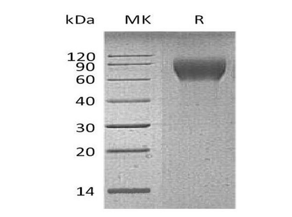 Mouse CD6/TP120 Recombinant Protein (RPES2010)