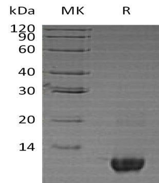 Human Neuritin/NRN1 Recombinant Protein (RPES2033)
