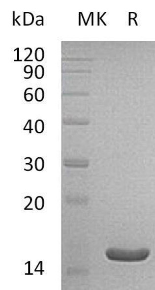 Human THEM2/ACOT13 Recombinant Protein (RPES2040)