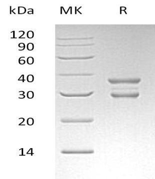 Human UBE2J2 Recombinant Protein (RPES2044)
