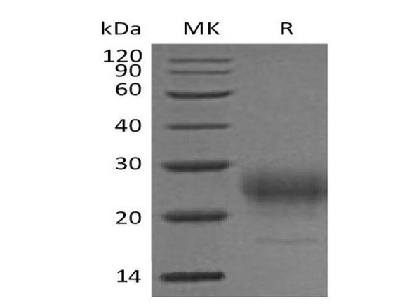 Mouse Interleukin-7/IL-7 Recombinant Protein (RPES2045)