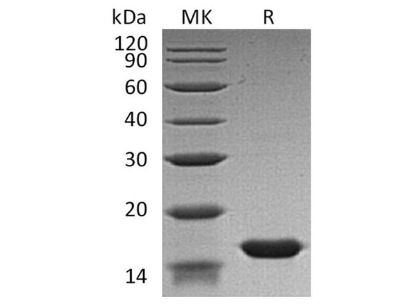 Human FABP3 Recombinant Protein (RPES2049)