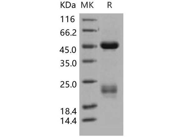 Coagulation Factor X/F10 Recombinant Protein (RPES2058)
