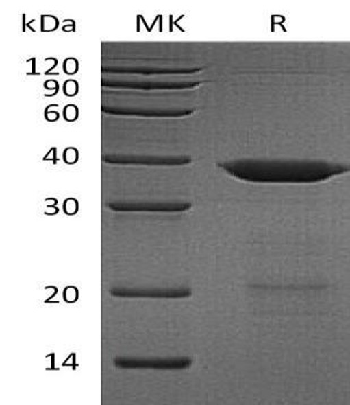 Human HIP2/UBE2K Recombinant Protein (RPES2063)