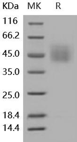 Human CD34 Recombinant Protein (RPES2076)