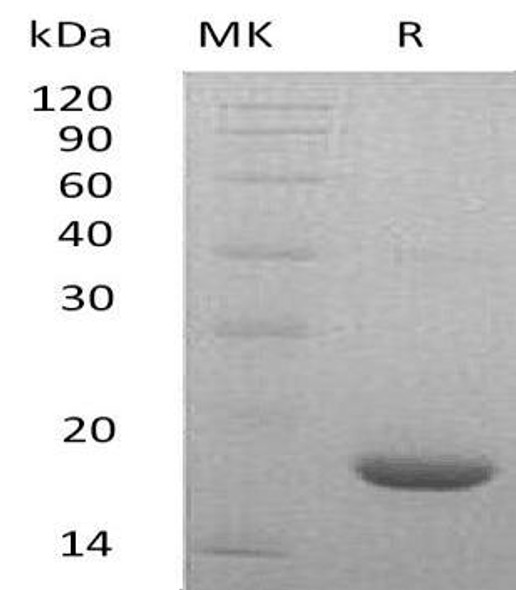 Mouse LIF Recombinant Protein (RPES2086)