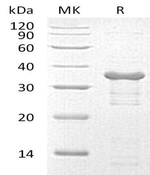 Human UBE2R2/UBC3B Recombinant Protein (RPES2104)