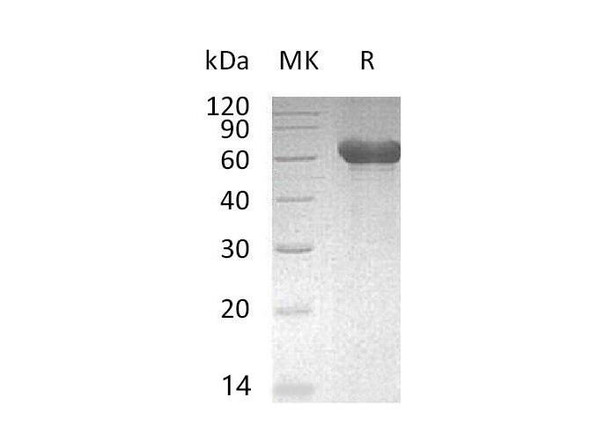 Mouse CD300a/LMIR1 Recombinant Protein (RPES2106)