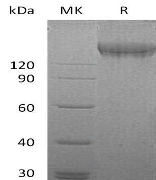 Human VEGFR2/Flk/KDR Recombinant Protein (RPES2114)