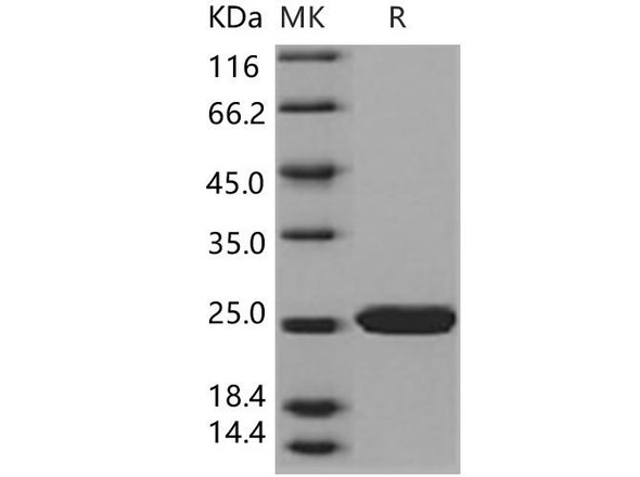 Human SOD2/Mn-SOD Recombinant Protein (RPES2115)