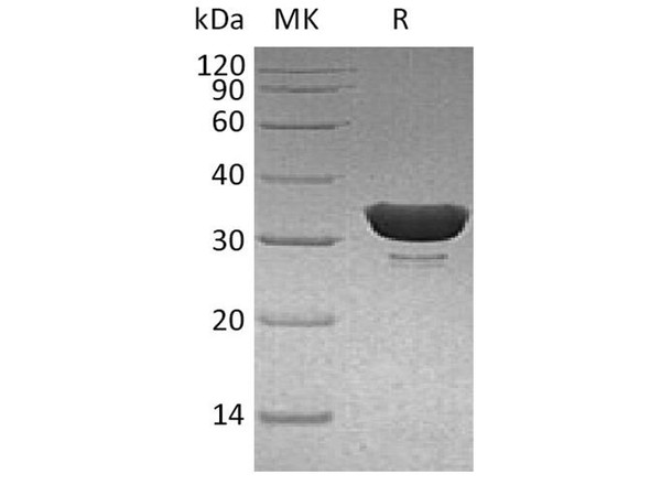 Human DCUN1D1 Recombinant Protein (RPES2123)