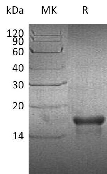 Human PDGF-AA Recombinant Protein  (RPES2125)
