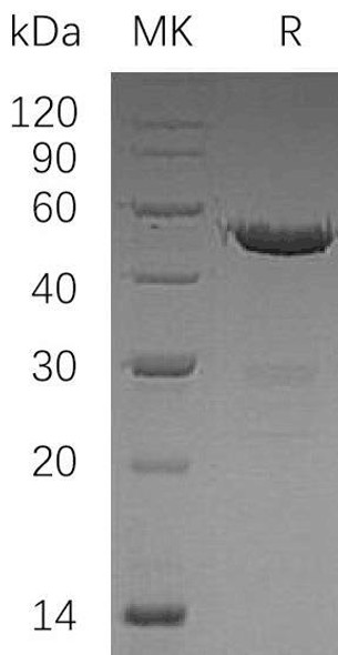 Human UBE2S Recombinant Protein (RPES2126)