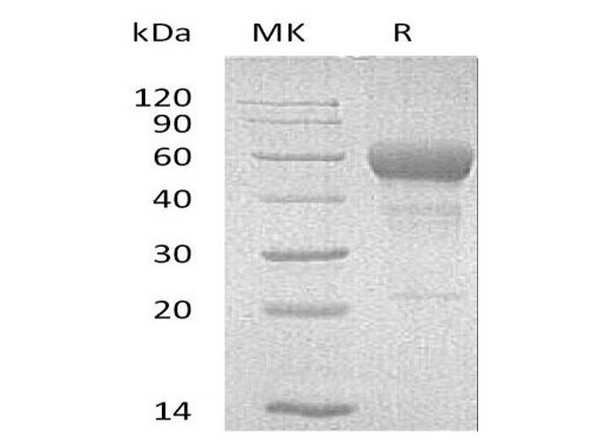 Mouse FAS/TNFRSF6 Recombinant Protein (RPES2135)