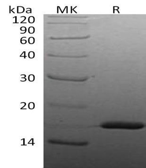 Human IL beta/IL1B Recombinant Protein (RPES2145)