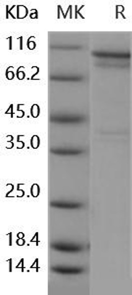 Human PS6K/RPS6KB1 Recombinant Protein (RPES2161)