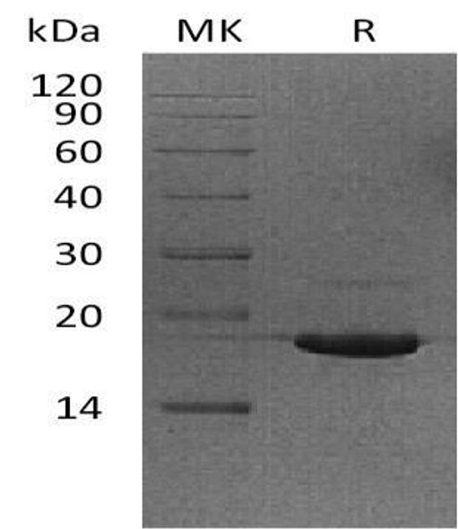 Human UBE2V2/DDVIT1 Recombinant Protein (RPES2169)