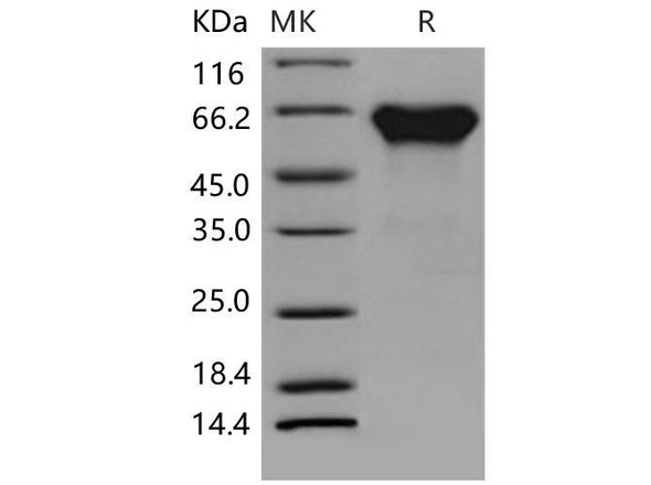 Mouse Activin RIIA/ACVR2A Recombinant Protein (RPES2170)