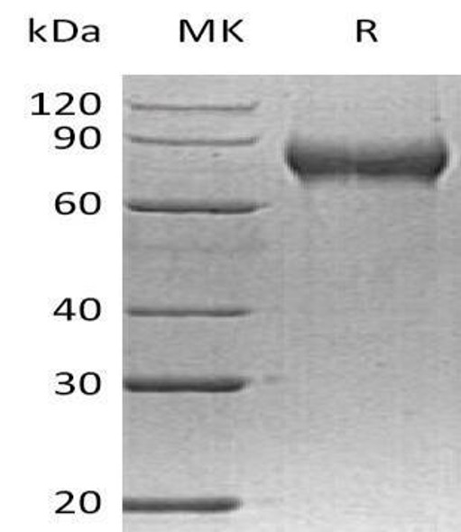 Human FLRT2 Recombinant Protein (RPES2180)