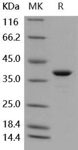 Human GAPDH Recombinant Protein (RPES2182)