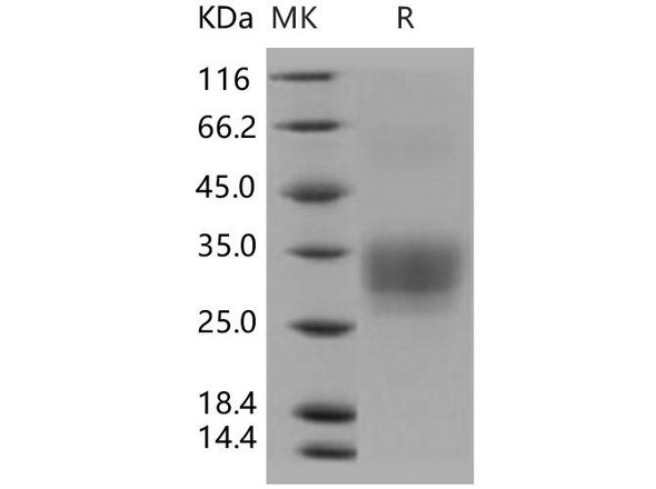 Human CD7/GP40 Recombinant Protein (RPES2185)