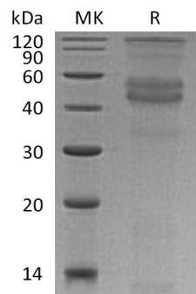 Human DMP1 Recombinant Protein (RPES2187)