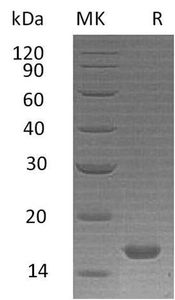 Human Interleukin-21/IL-21 Recombinant Protein  (RPES2209)