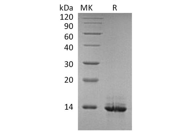 Human HMGB1 Recombinant Protein (RPES2218)