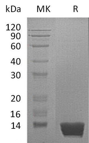 Mouse MIF Recombinant Protein (RPES2233)