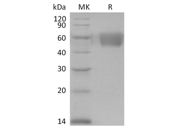 Human FCGR1A/CD64 Recombinant Protein (RPES2238)