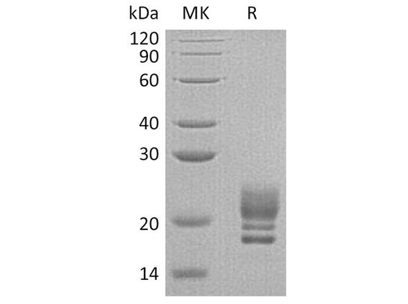Human COQ7 Recombinant Protein (RPES2258)