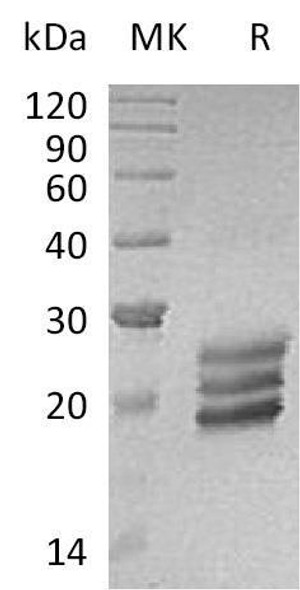 Human Interleukin-25/IL-25 Recombinant Protein (RPES2270)